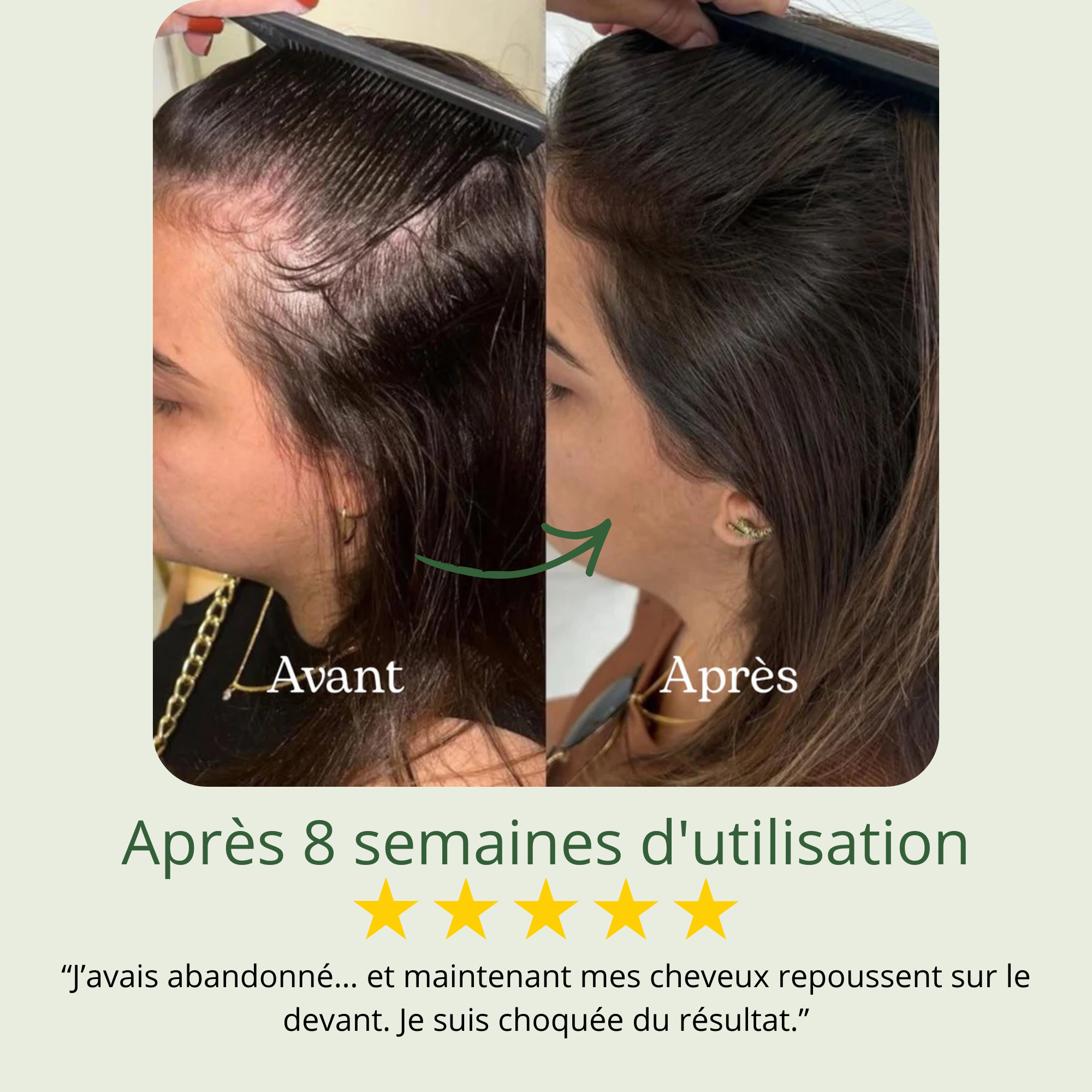 Shampoing Repousse & Densité DENSILIA