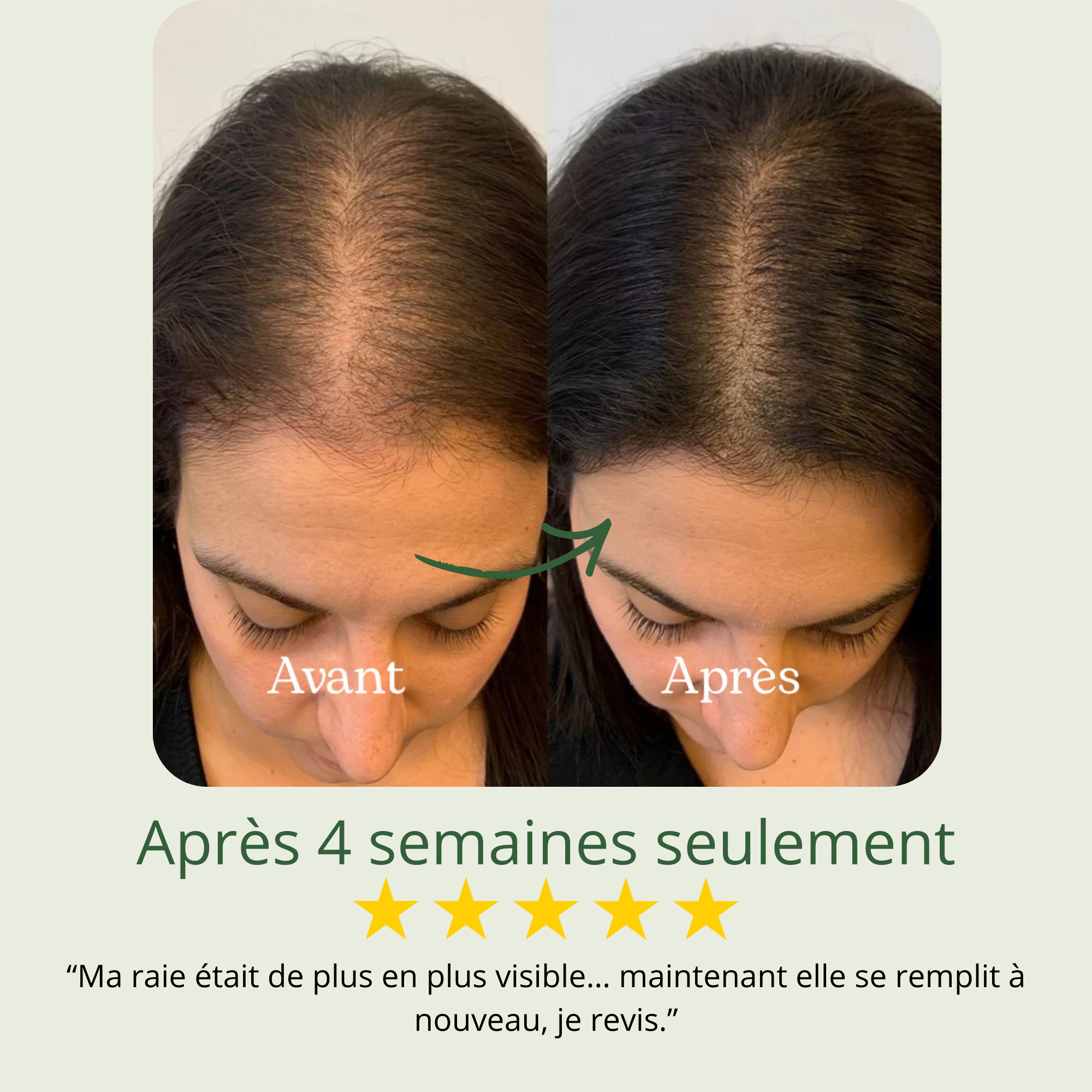 Shampoing Repousse & Densité DENSILIA