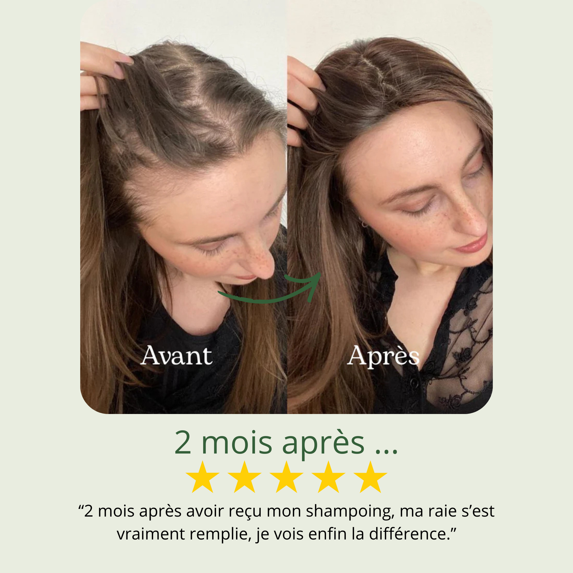 Shampoing Repousse & Densité DENSILIA