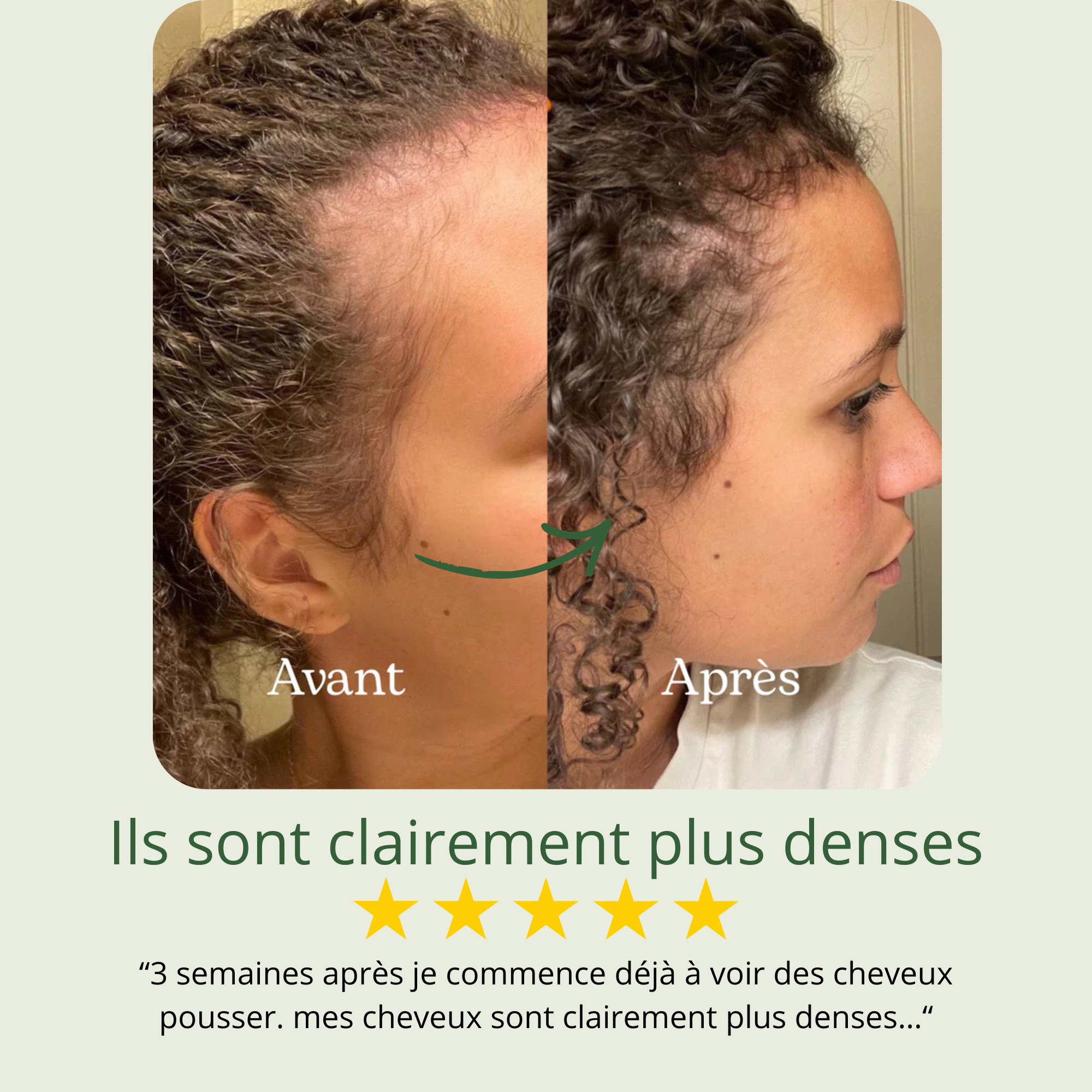 Shampoing Repousse & Densité DENSILIA