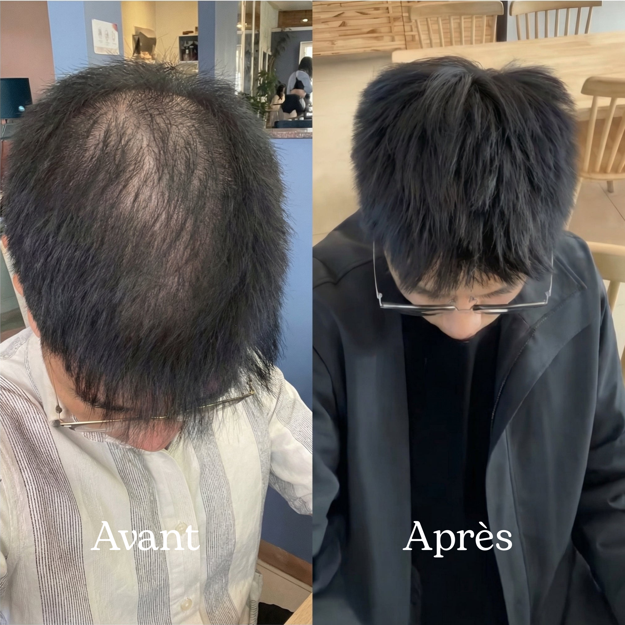 Shampoing Repousse & Densité DENSILIA