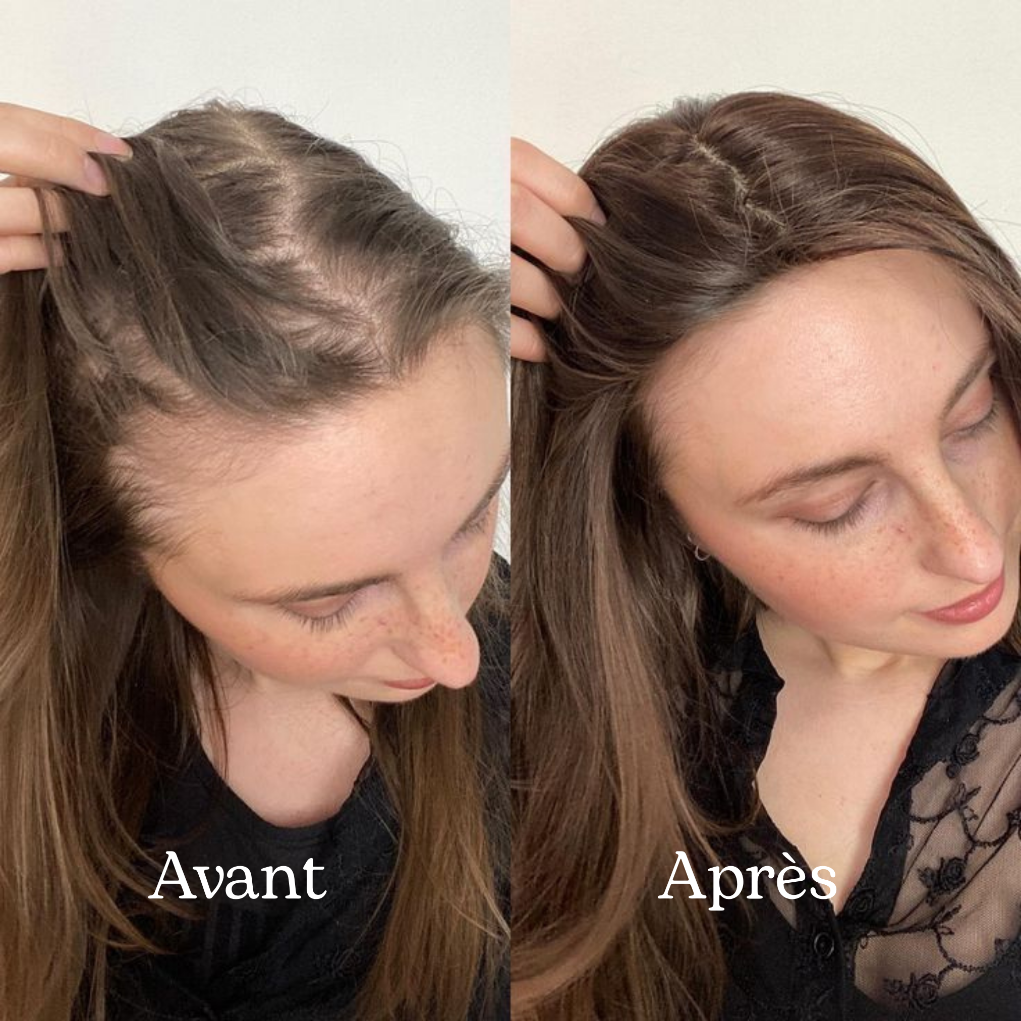 Shampoing Repousse & Densité DENSILIA