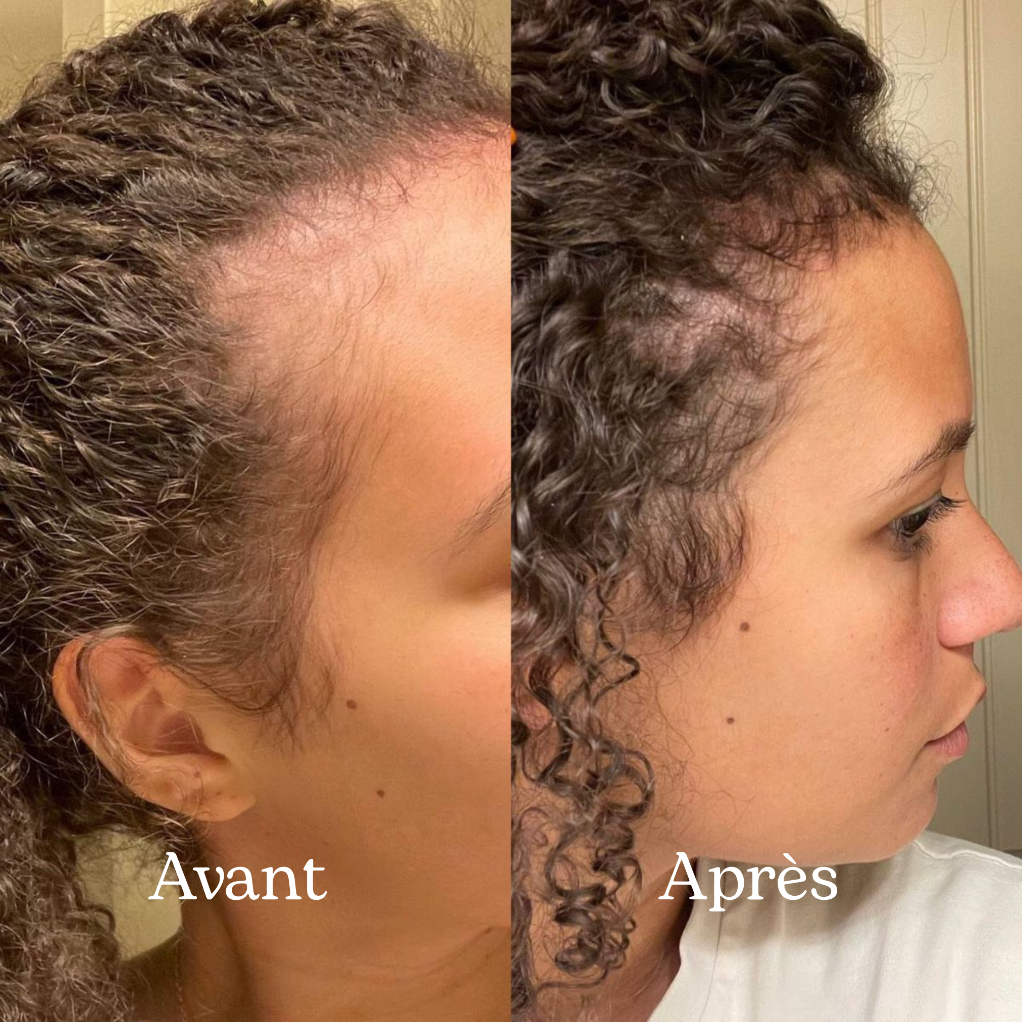 Shampoing Repousse & Densité DENSILIA